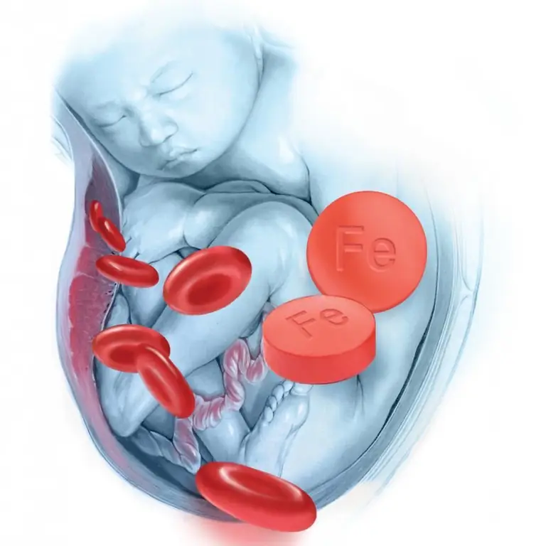 Rauavaegusaneemia äratundmine ja ravi