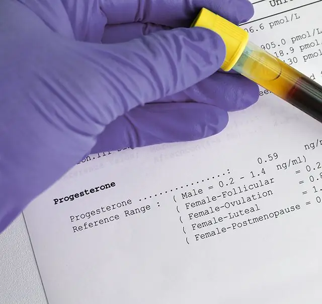 Normas de progesterona por semana de embarazo: indicadores, causas de desviaciones en diferentes períodos
