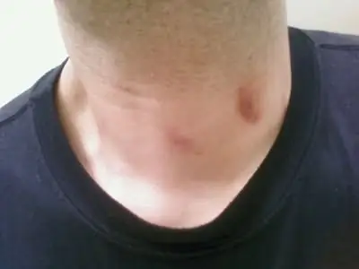 hickeys jinsi ya kuweka