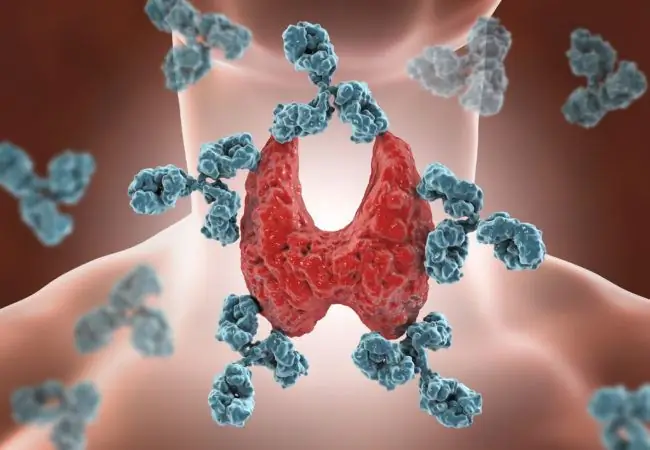 Autoimunitná tyroiditída počas tehotenstva: príznaky, liečba, účinky na plod