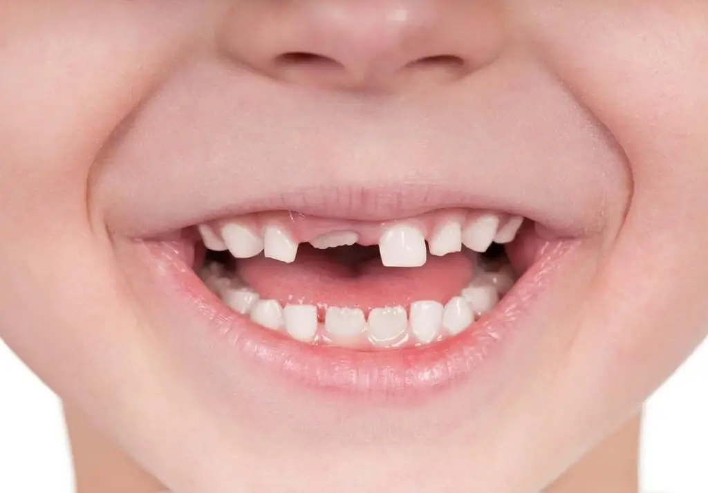 Until what age do children's teeth grow? In what order do teeth grow in children?