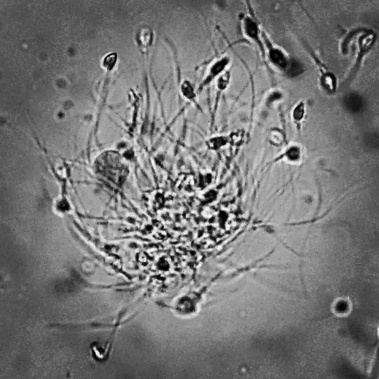 Female ejaculate as normal physiological excretion