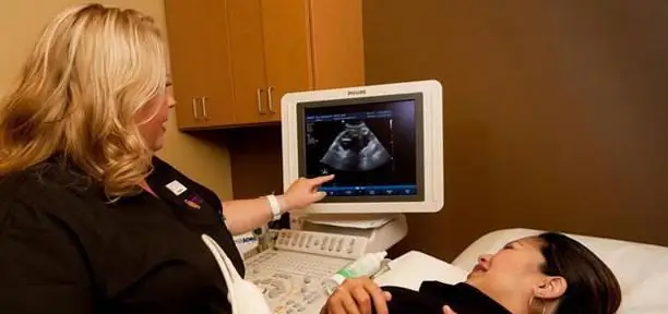 Norm for screening ultrasound of the 1st trimester. Screening of the 1st trimester: terms, norms for ultrasound, ultrasound interpretation