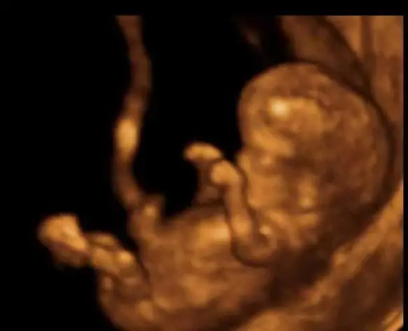 Apa yang berlaku pada minggu ke-12 kehamilan. Kehamilan 12 minggu: saiz janin, jantina bayi, gambar ultrasound