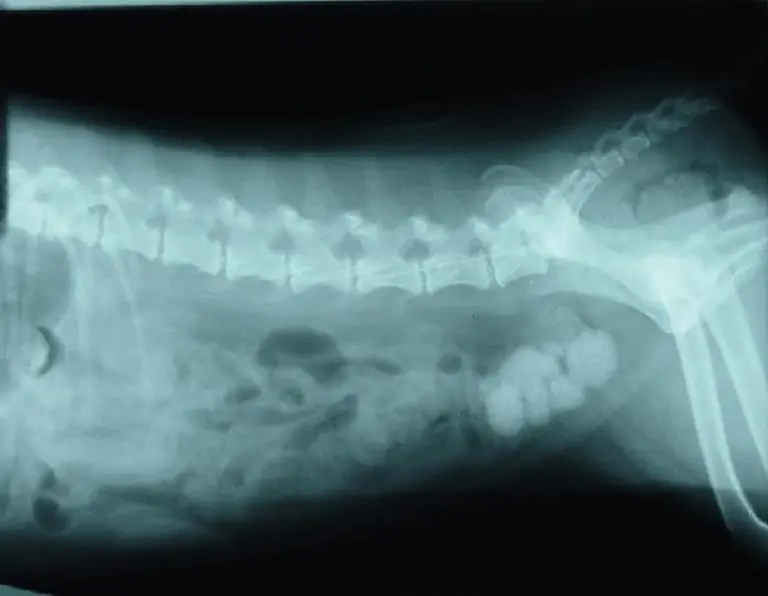 Diagnosis of urolithiasis