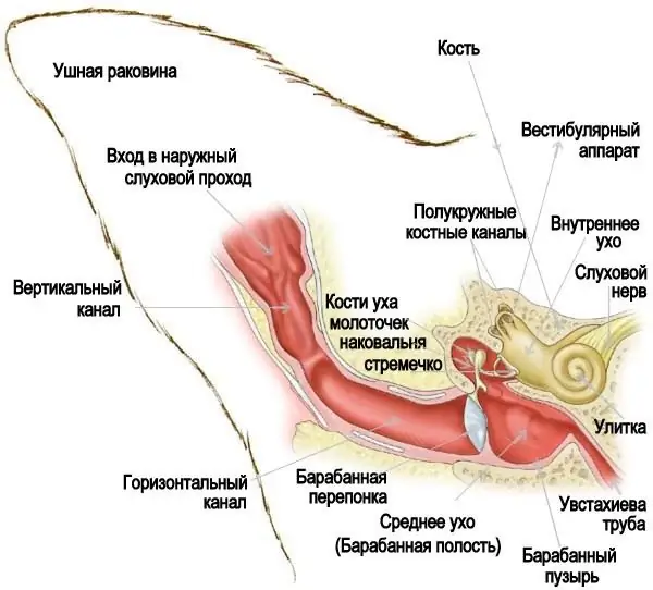 Otitis hauv dev: kho nrog tshuaj tua kab mob thiab tshuaj pej xeem. Hom thiab cov tsos mob ntawm otitis media hauv dev