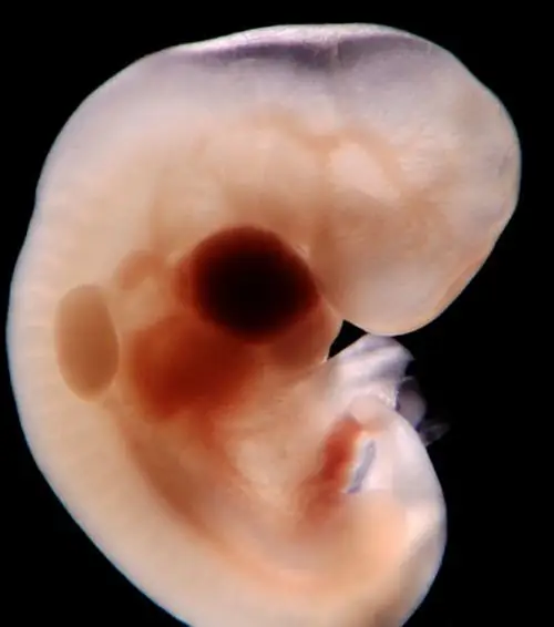 Daim duab embryo