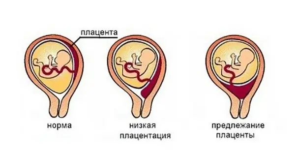 პრეზენტაციის სახეები