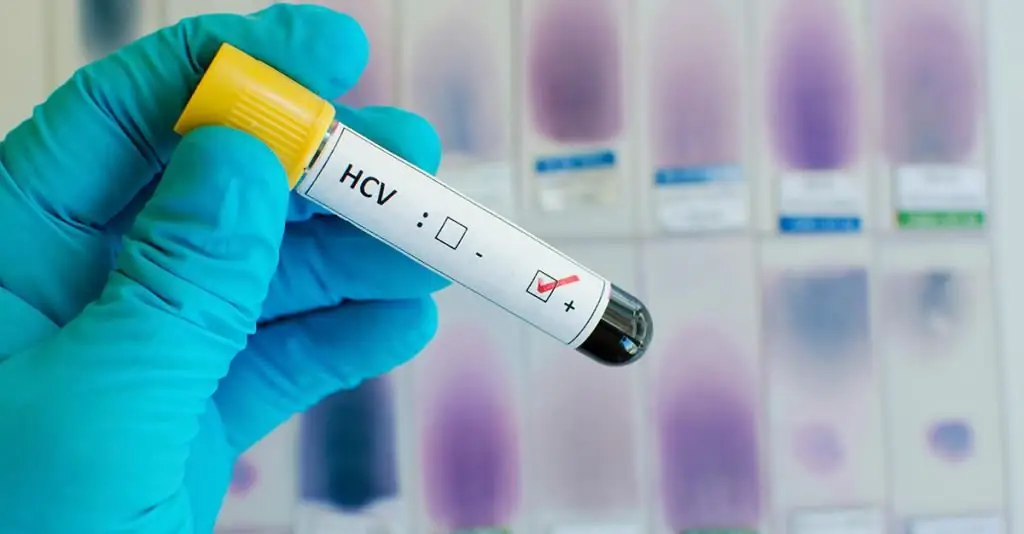 Hepatitis-C-Test